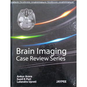 Brain Imaging • Case Review Series • Jaypee