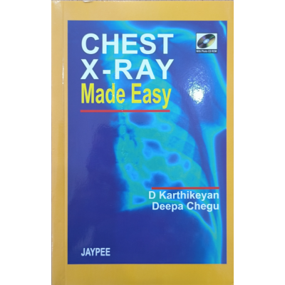 Chest X-Ray Made Easy • Jaypee